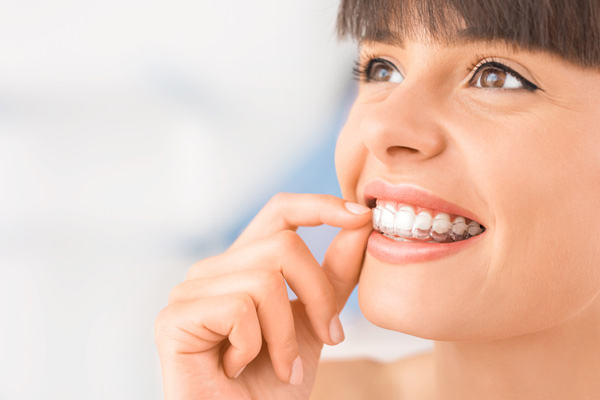 Smiling woman looking up holding clear aligners over teeth