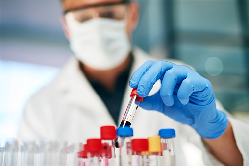 Dentist with blood sample done at Myers Park Dental Partners in Charlotte, NC